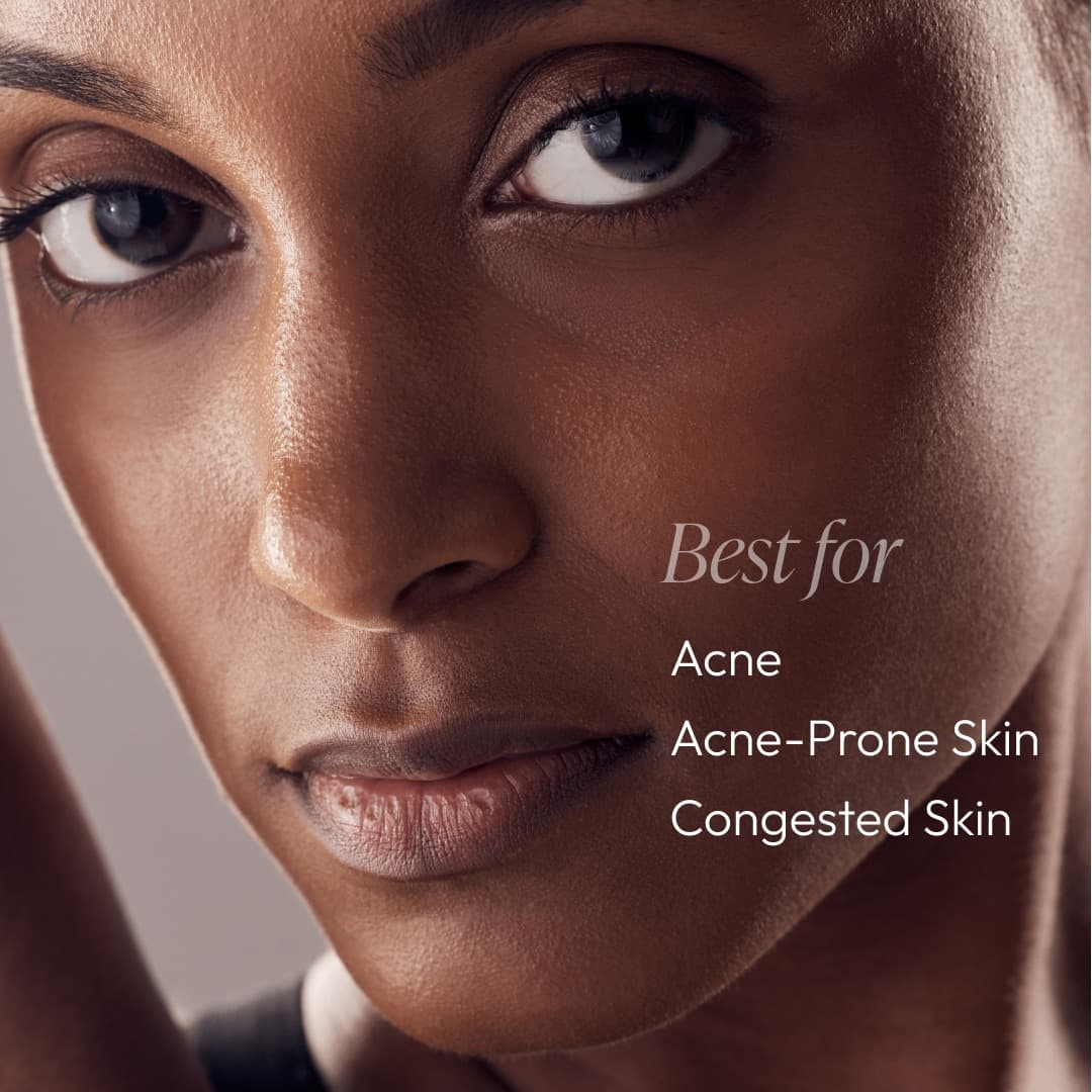 Nighttime Control Acne Treatment Lotion — view 4