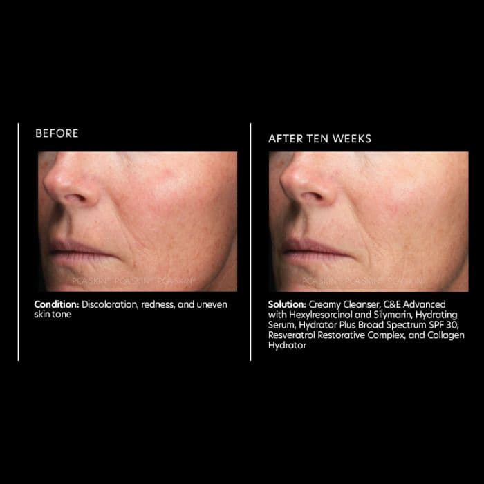 Resveratrol Restorative Complex — view 2