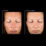 Hyaluronic Acid Overnight Mask — view 4