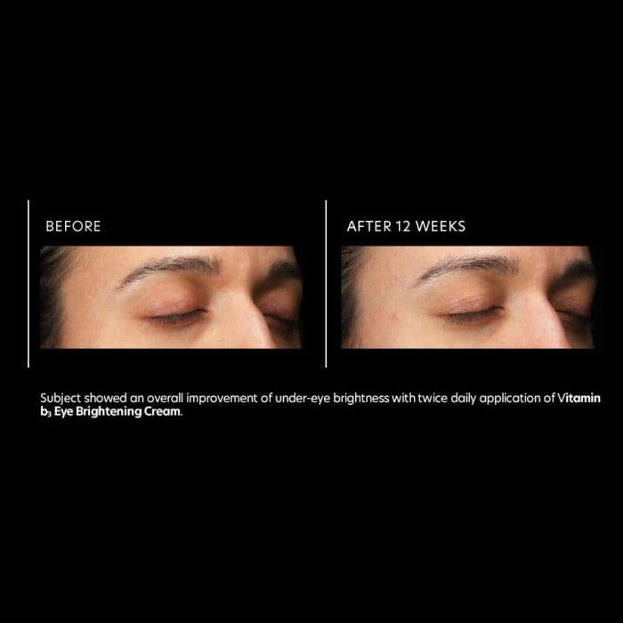 Vitamin b3 Eye Brightening Cream — view 2