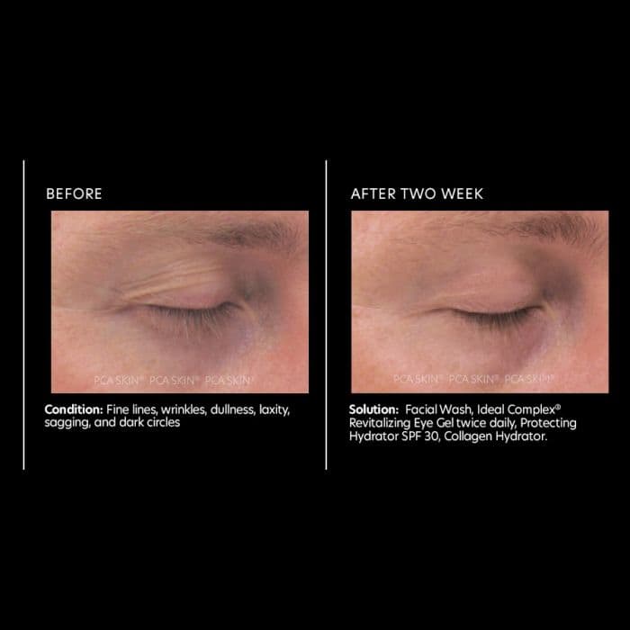 Ideal Complex® revitalizing eye gel — view 4