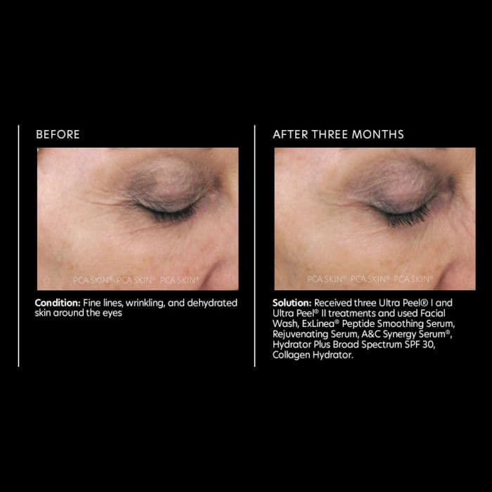 Rejuvenating Serum — view 2
