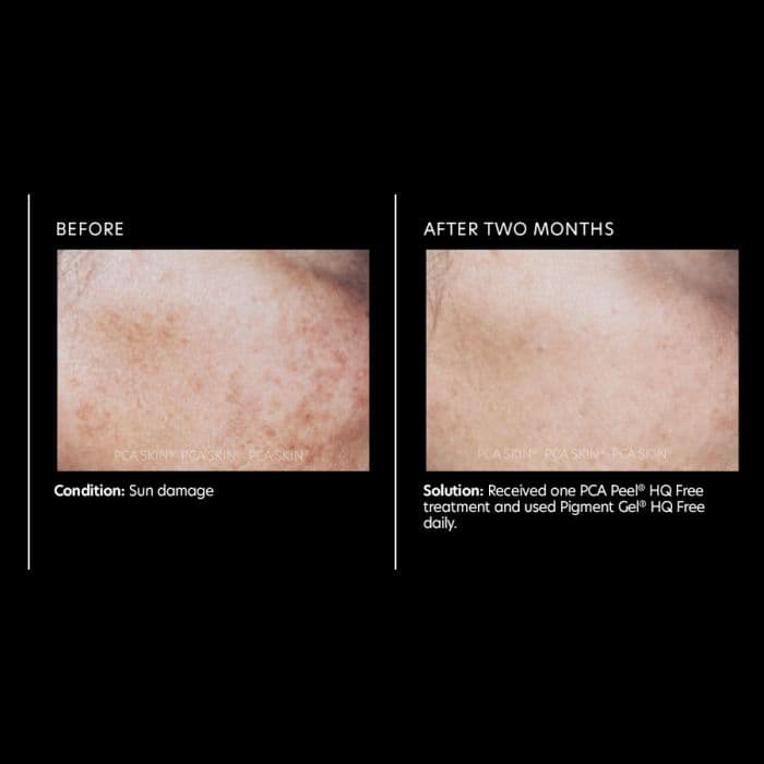 Pigment Gel® HQ Free — view 2