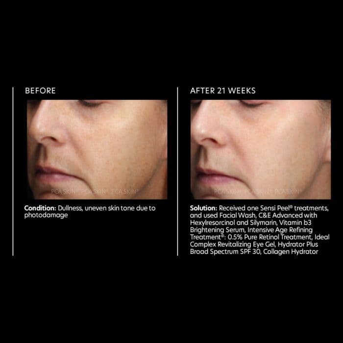 Vitamin b3 Brightening Serum — view 4