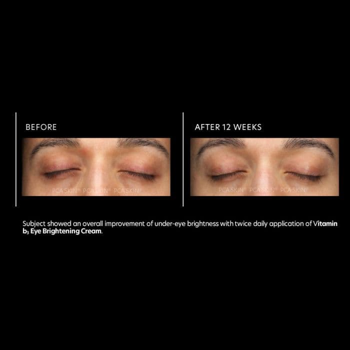 Vitamin b3 Eye Brightening Cream — view 3