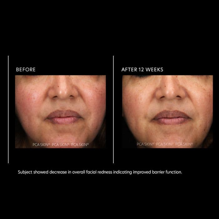 Resurfacing Serum — view 4