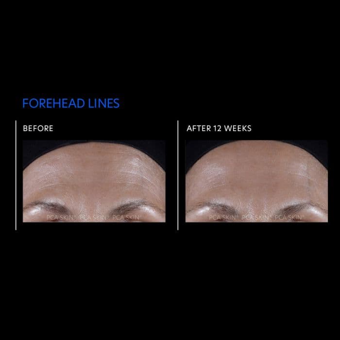 ExLinea Pro® Peptide Serum — view 2